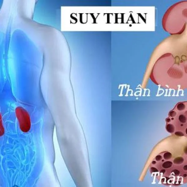 Triệu chứng suy thận ở nam giới